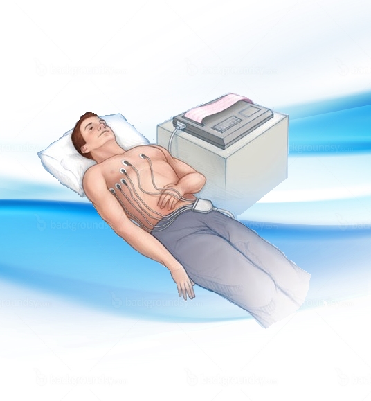 Electrocardiograma (ECG)